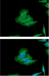 Anti-Calcineurin A antibody [AT1E11] used in Immunocytochemistry/ Immunofluorescence (ICC/IF). GTX57730