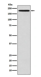 Anti-GCN2 antibody [ACAA-5] used in Western Blot (WB). GTX57742