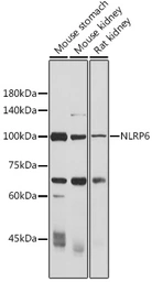Anti-NALP6 antibody used in Western Blot (WB). GTX57752