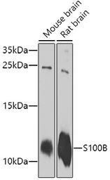 Anti-S100 beta antibody used in Western Blot (WB). GTX57757
