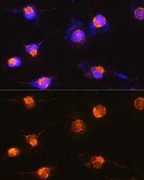 Anti-S100 beta antibody used in Immunocytochemistry/ Immunofluorescence (ICC/IF). GTX57757