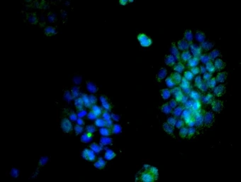 Anti-Cyclin D2 antibody used in Immunocytochemistry/ Immunofluorescence (ICC/IF). GTX60131