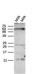 Anti-Kappa casein antibody used in Western Blot (WB). GTX60145