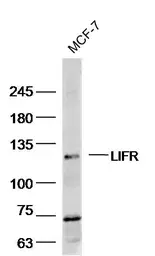 Anti-LIFR antibody used in Western Blot (WB). GTX60183