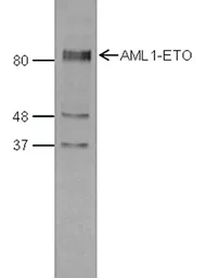 Anti-AML1-ETO antibody - ChIP grade used in Western Blot (WB). GTX60339