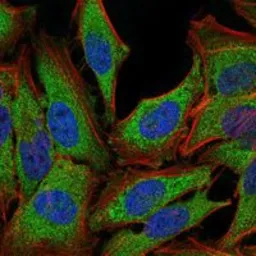 Anti-Glucocorticoid Receptor antibody [6E6] used in Immunocytochemistry/ Immunofluorescence (ICC/IF). GTX60389