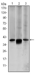 Anti-MEK6 antibody [3H12B9] used in Western Blot (WB). GTX60397
