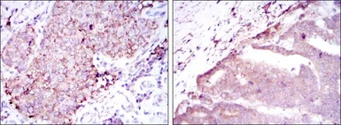 Anti-BMPR2 antibody [1F12] used in IHC (Paraffin sections) (IHC-P). GTX60414