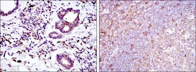 Anti-Bid antibody [3C5] used in IHC (Paraffin sections) (IHC-P). GTX60429