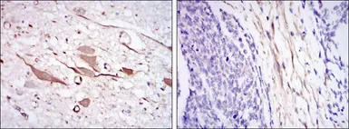 Anti-HSP27 antibody [5D7] used in IHC (Paraffin sections) (IHC-P). GTX60444