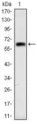 Anti-OTX2 antibody [1H12C4B5] used in Western Blot (WB). GTX60448