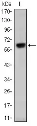 Anti-OTX2 antibody [1H12G8B2] used in Western Blot (WB). GTX60449