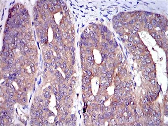 Anti-CBL antibody [3B12] used in IHC (Paraffin sections) (IHC-P). GTX60481