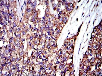 Anti-CRK antibody [3G11C1] used in IHC (Paraffin sections) (IHC-P). GTX60487