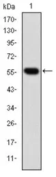 Anti-TCP1 beta antibody [5B5F5] used in Western Blot (WB). GTX60497