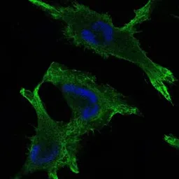 Anti-gamma Catenin antibody [4C12] used in Immunocytochemistry/ Immunofluorescence (ICC/IF). GTX60501