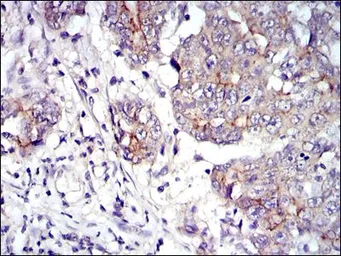 Anti-gamma Catenin antibody [4C12] used in IHC (Paraffin sections) (IHC-P). GTX60501