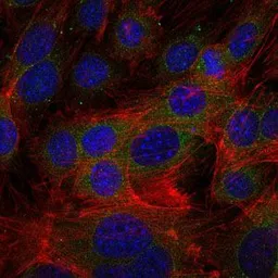 Anti-Fibrinogen gamma antibody [4H9] used in Immunocytochemistry/ Immunofluorescence (ICC/IF). GTX60502