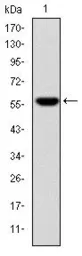 Anti-Fibrinogen gamma antibody [4H9] used in Western Blot (WB). GTX60502