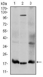 Anti-UBE2I antibody [1B10] used in Western Blot (WB). GTX60512