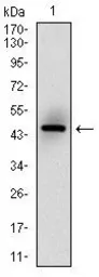 Anti-MSH6 antibody [5B11] used in Western Blot (WB). GTX60514