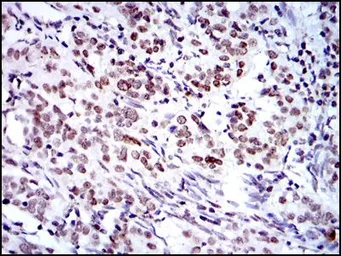 Anti-Bmi1 antibody [3E3] used in IHC (Paraffin sections) (IHC-P). GTX60516