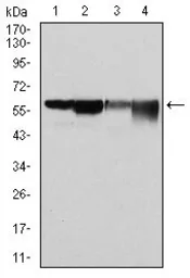 Anti-G6PD antibody [2H7] used in Western Blot (WB). GTX60518