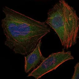Anti-Troponin I fast skeletal muscle antibody [2F12G2] used in Immunocytochemistry/ Immunofluorescence (ICC/IF). GTX60531