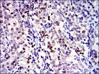 Anti-Survivin antibody [1H5] used in IHC (Paraffin sections) (IHC-P). GTX60534