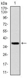 Anti-FOXO1 antibody [3B6] used in Western Blot (WB). GTX60558