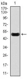 Anti-C Reactive Protein antibody [1G1] used in Western Blot (WB). GTX60566