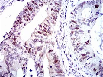Anti-CDK2 antibody [1A6] used in IHC (Paraffin sections) (IHC-P). GTX60572
