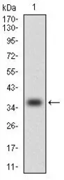 Anti-MCP1 / CCL2 antibody [2D8] used in Western Blot (WB). GTX60582
