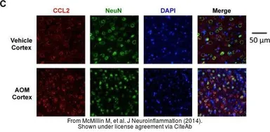 Anti-MCP1 / CCL2 antibody [2D8] used in IHC (Frozen sections) (IHC-Fr). GTX60582