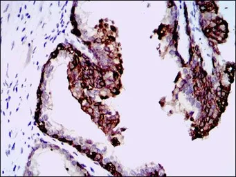 Anti-HAS3 antibody [3C9] used in IHC (Paraffin sections) (IHC-P). GTX60588