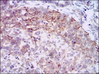 Anti-HAS3 antibody [3C9] used in IHC (Paraffin sections) (IHC-P). GTX60588