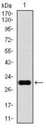 Anti-Glypican-3 antibody [9C2] used in Western Blot (WB). GTX60603