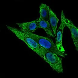 Anti-Rho GDI alpha antibody [2G3] used in Immunocytochemistry/ Immunofluorescence (ICC/IF). GTX60618