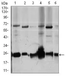 Anti-Rho GDI alpha antibody [2G3] used in Western Blot (WB). GTX60618