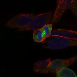 Anti-PLK1 antibody [1D1] used in Immunocytochemistry/ Immunofluorescence (ICC/IF). GTX60624