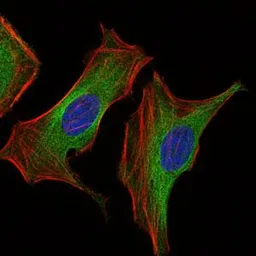 Anti-IGF2 antibody [8H1] used in Immunocytochemistry/ Immunofluorescence (ICC/IF). GTX60630