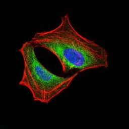 Anti-PI3 kinase p85 alpha antibody [6G10] used in Immunocytochemistry/ Immunofluorescence (ICC/IF). GTX60633