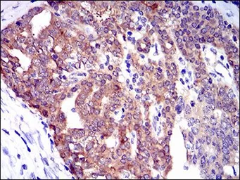 Anti-PTK9 antibody [7C11] used in IHC (Paraffin sections) (IHC-P). GTX60638
