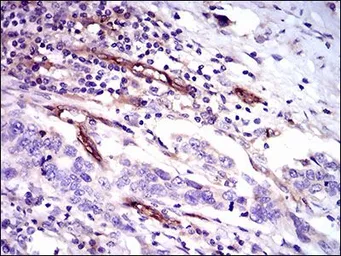 Anti-CD59 antibody [8D2B8] used in IHC (Paraffin sections) (IHC-P). GTX60658