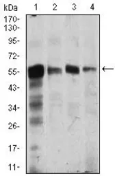 Anti-CaMKIV antibody [8C5B8] used in Western Blot (WB). GTX60667