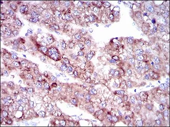 Anti-SLC27A5 antibody [9C4D1] used in IHC (Paraffin sections) (IHC-P). GTX60703