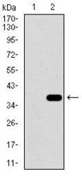 Anti-SLC27A5 antibody [9C4D1] used in Western Blot (WB). GTX60703