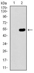 Anti-CBX8 antibody [9C3D4] used in Western Blot (WB). GTX60704