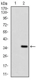 Anti-FGF4 antibody [2D7D5] used in Western Blot (WB). GTX60747