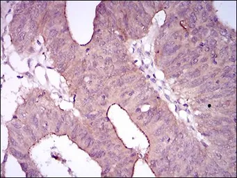 Anti-CD41 antibody [2E10C9] used in IHC (Paraffin sections) (IHC-P). GTX60763